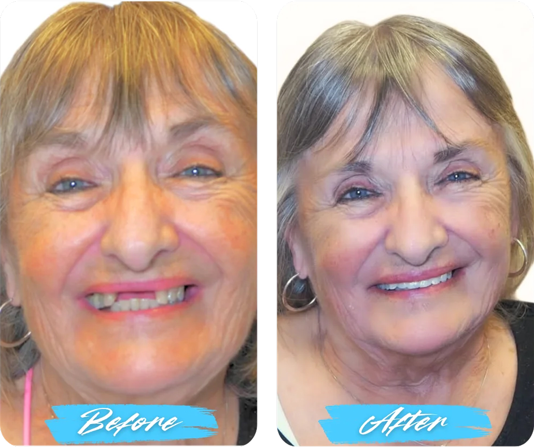Before After Image