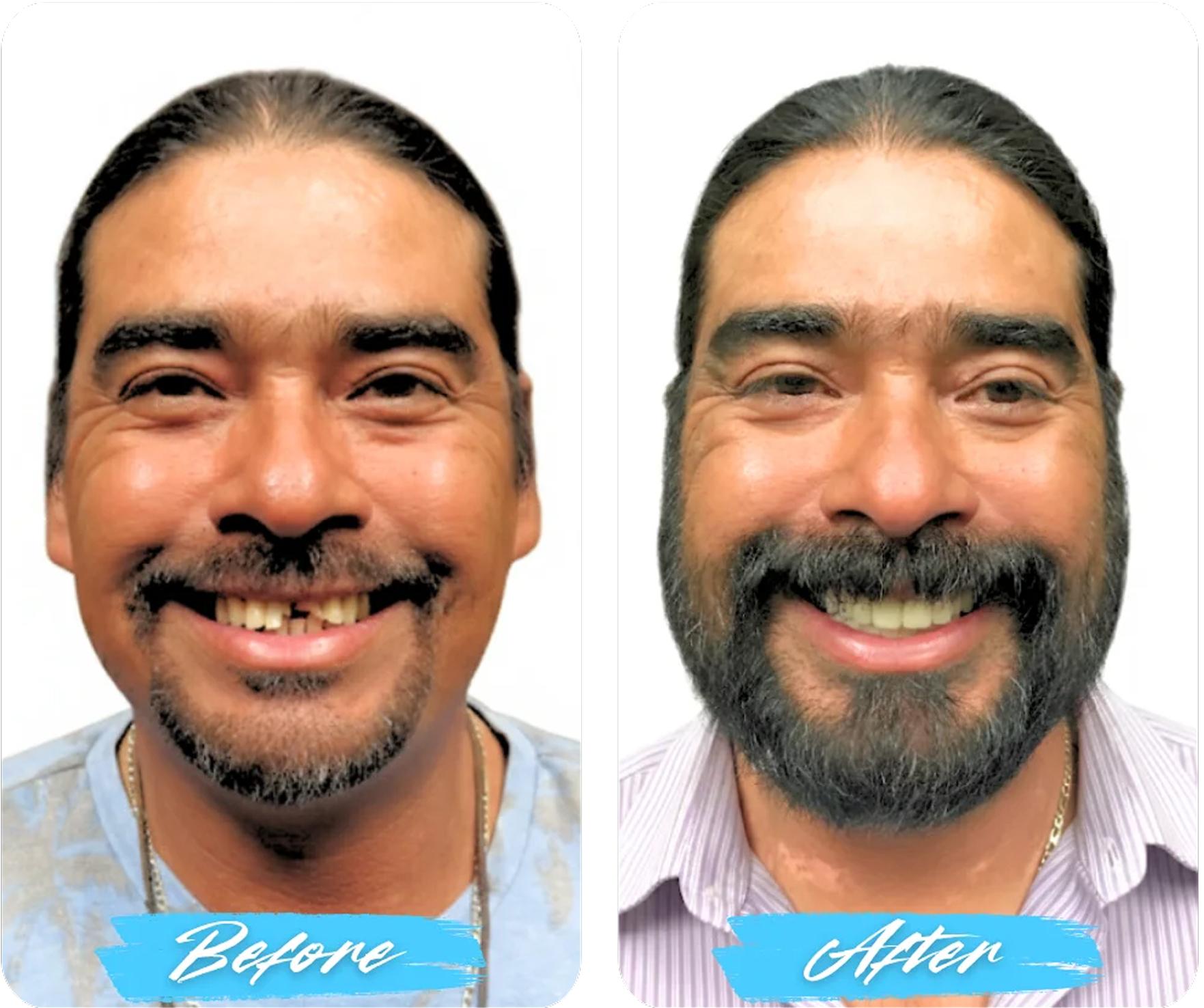 Before After Image