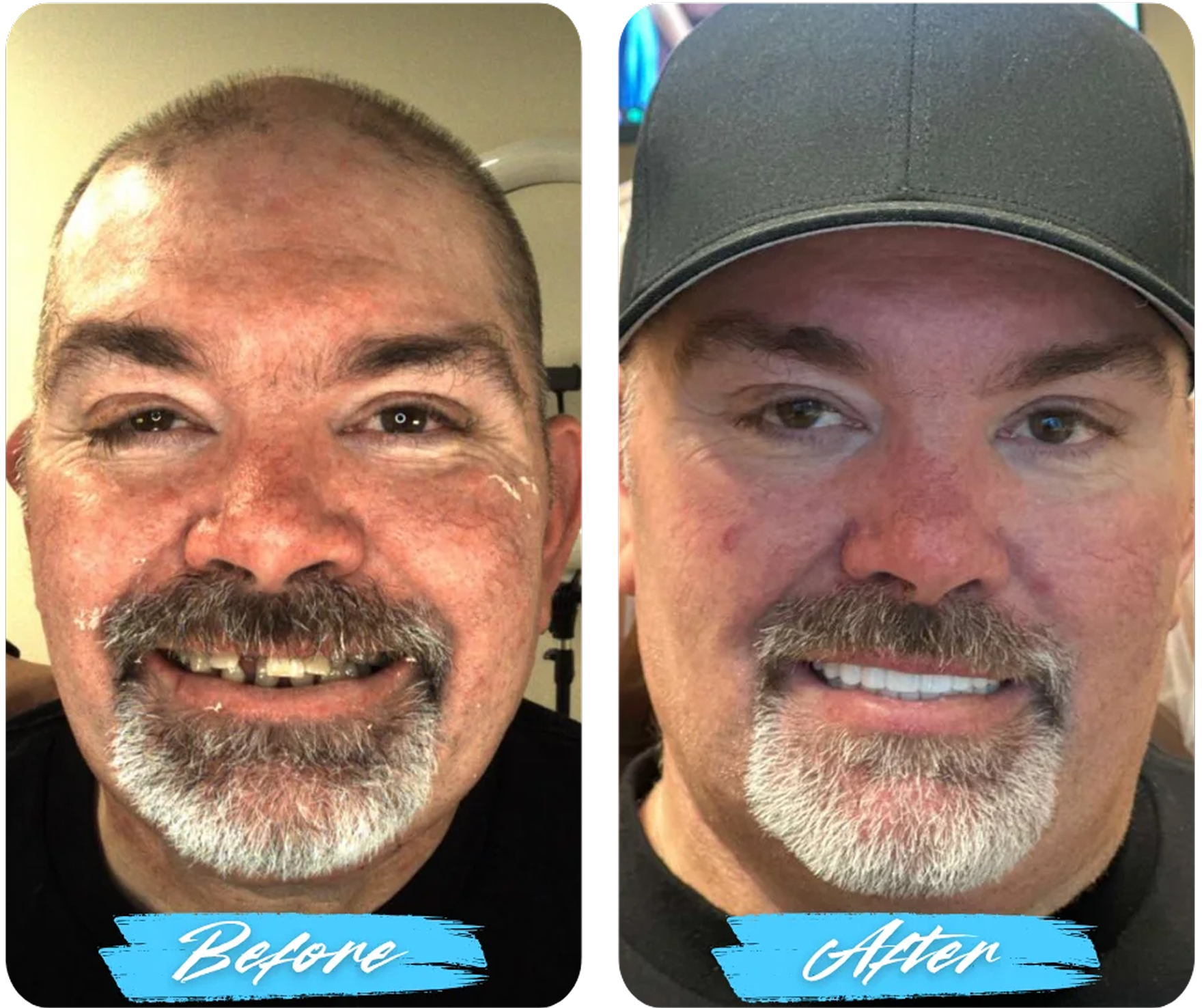 Before After Image