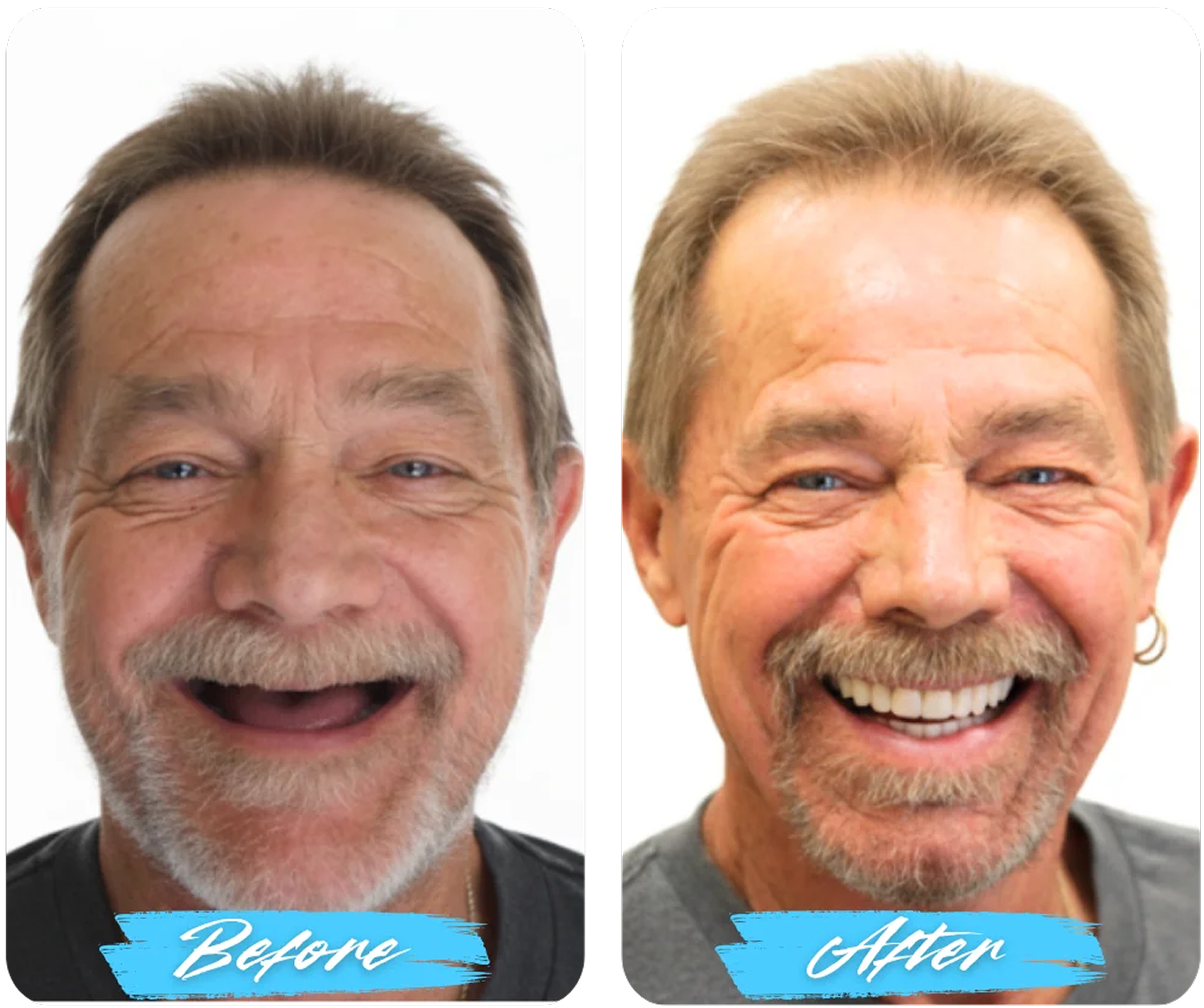 Before After Image