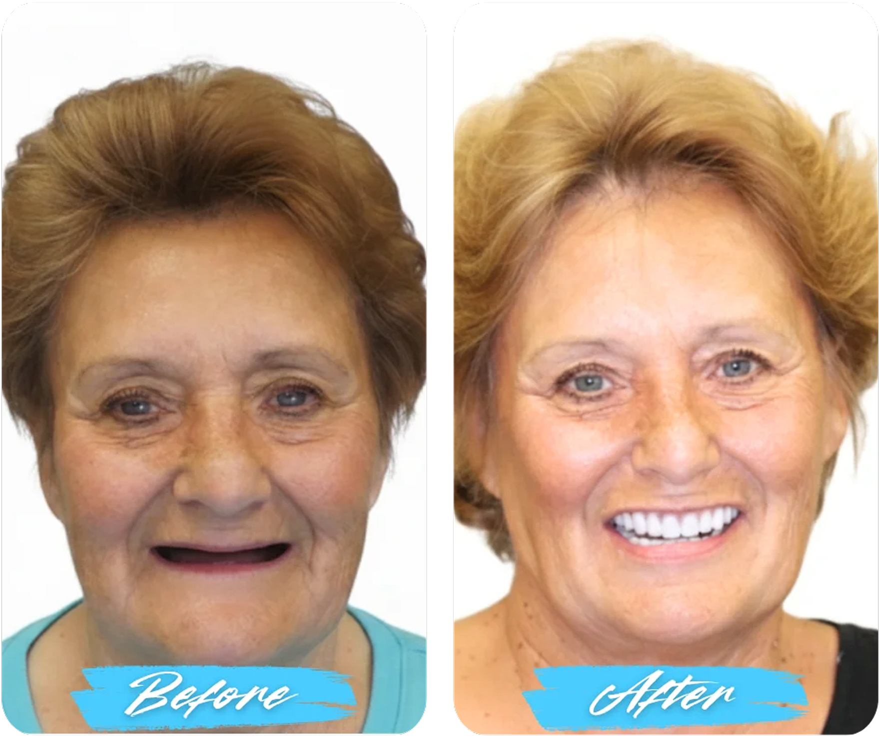 Before After Image
