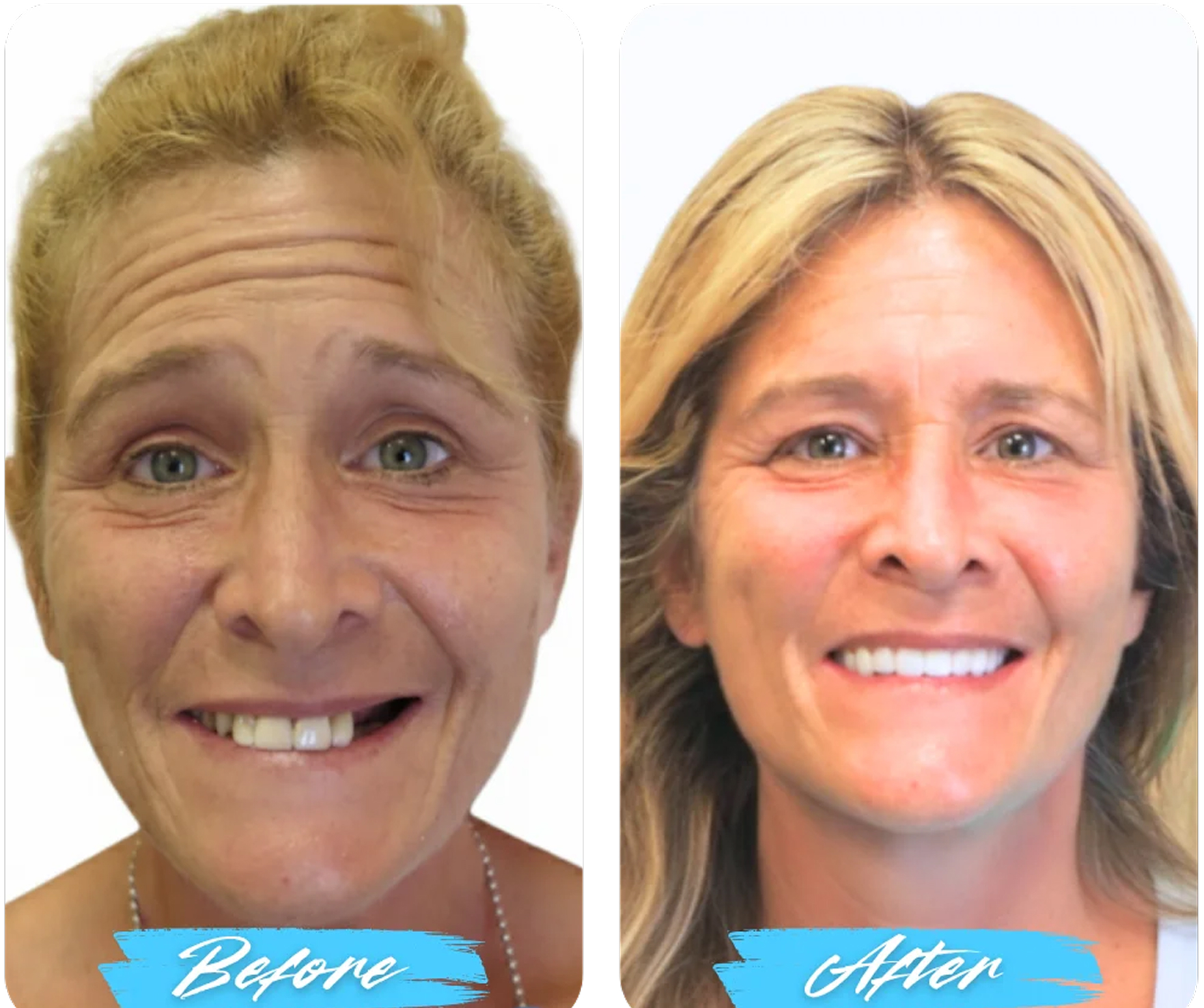 Before After Image