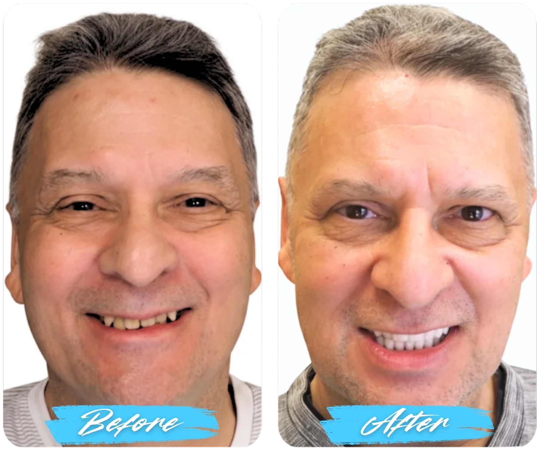 Before After Image